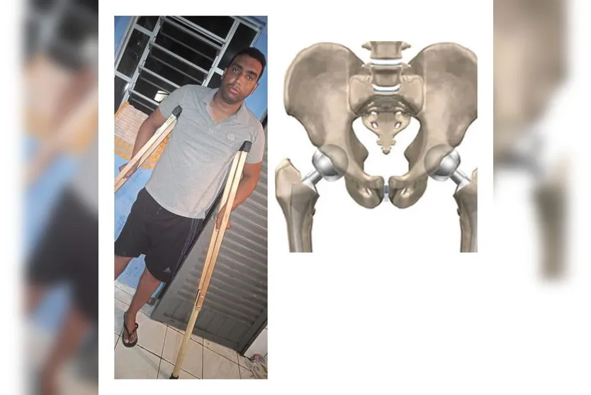  Anderson conta com a solidariedade das pessoas 