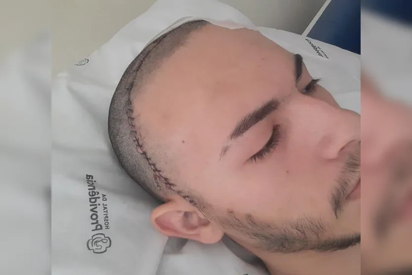 'Só agradecer', diz apucaranense que tirou tumor cerebral