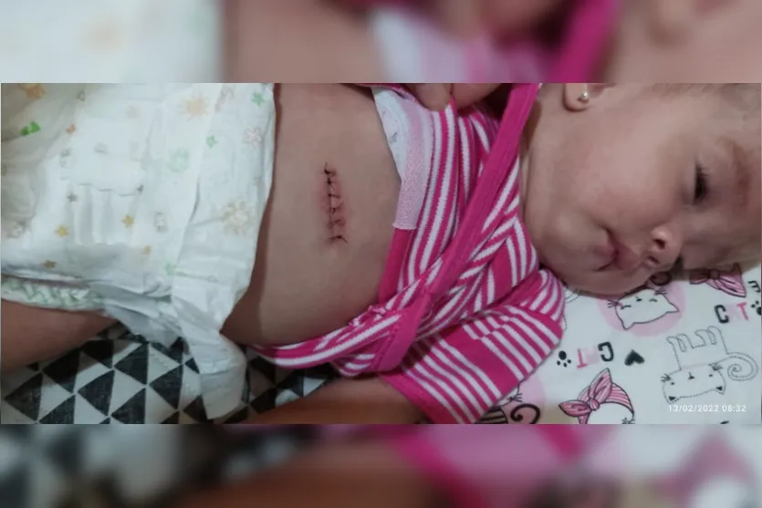Mãe de Apucarana faz rifa em prol de filha com hidrocefalia