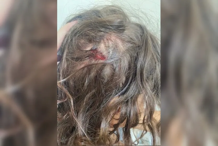 Criança volta da escola com hematomas e corte na boca