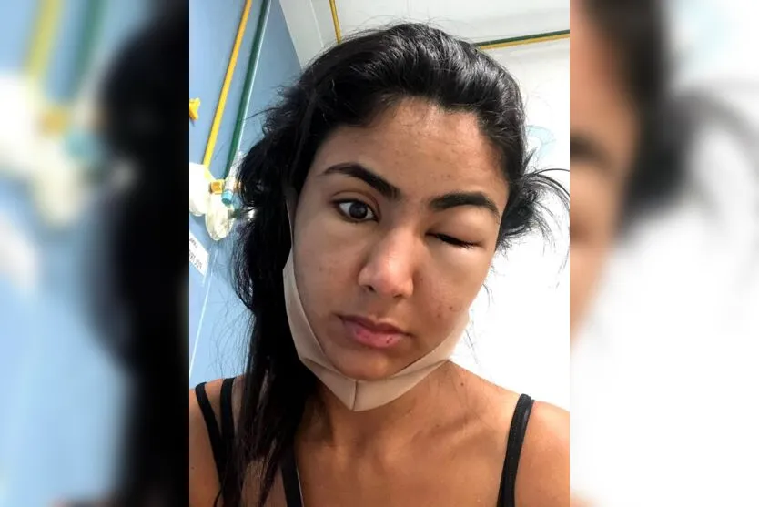  Amanda alegou que, por estar com o rosto inchado, as pessoas acreditavam que ela havia sido vítima de agressão 