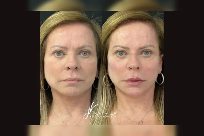  Comparação foi publicada pela apresentadora nas redes sociais 