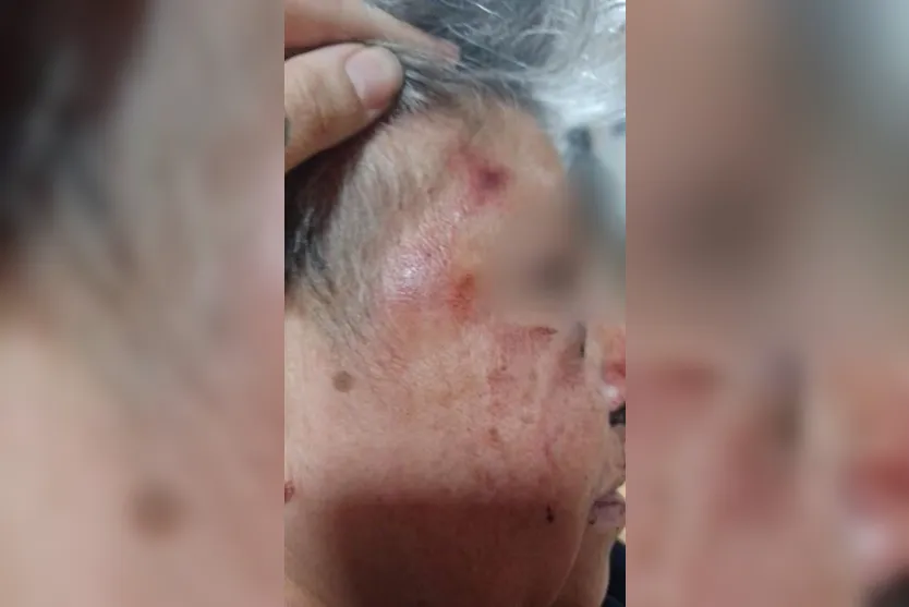  Ela foi encaminhada para atendimento médico no hospital Honpar 