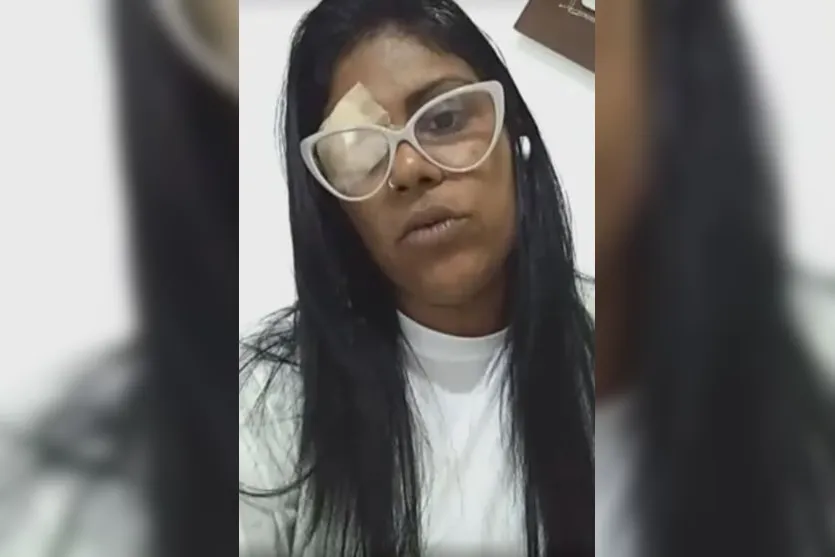  Bruna perdeu a visão do olho direito após ser atacada por um desconhecido 