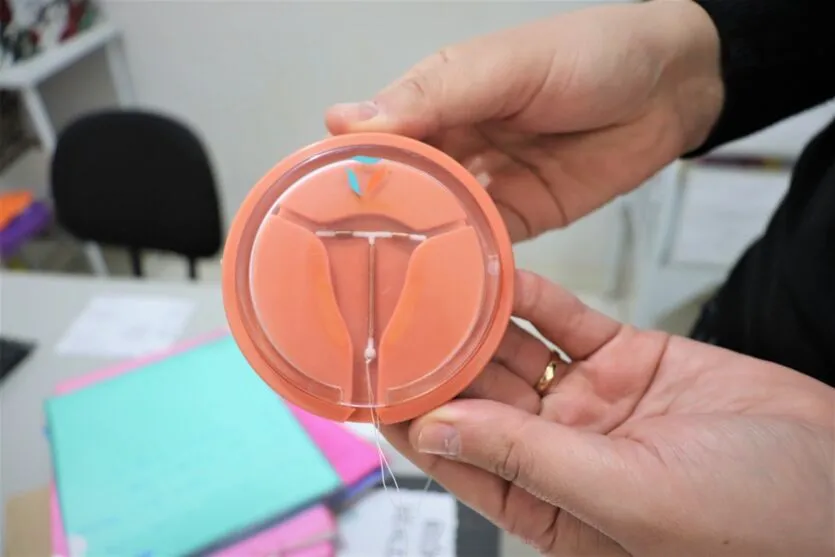  No Cisam, os atendimentos para os implantes de DIU acontecem todas as segundas, terças e sextas-feiras 