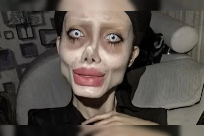  A mulher afirmava que tinha feito mais de 50 cirurgias para se parecer com a atriz Angelina Jolie 