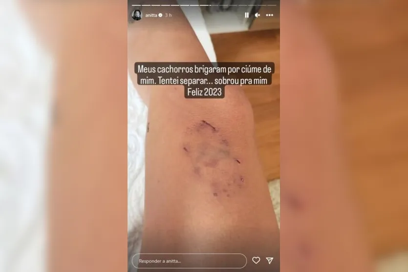 Anitta é mordida por cachorros ao tentar separar briga; veja imagens