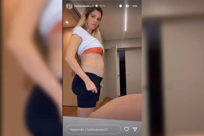 Grávida de gêmeos, Bárbara Evans impressiona ao mostrar a barriga