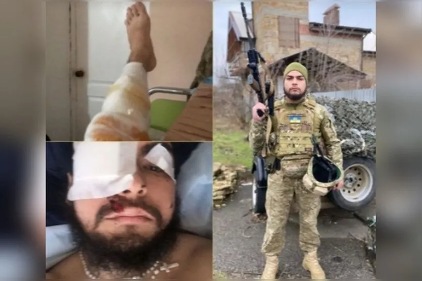  O soldado brasileiro fraturou as pernas e perdeu a visão do olho esquerdo 