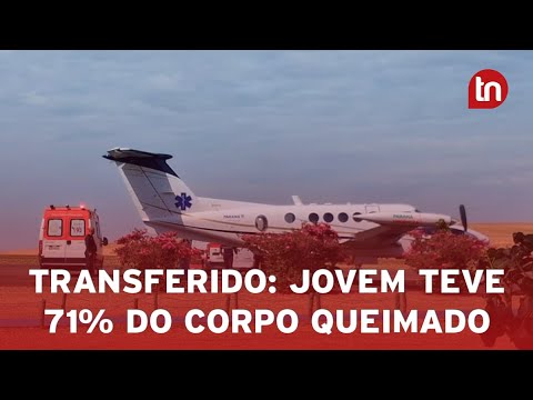 Jovem apucaranense que sofreu queimaduras é transferido para Curitiba