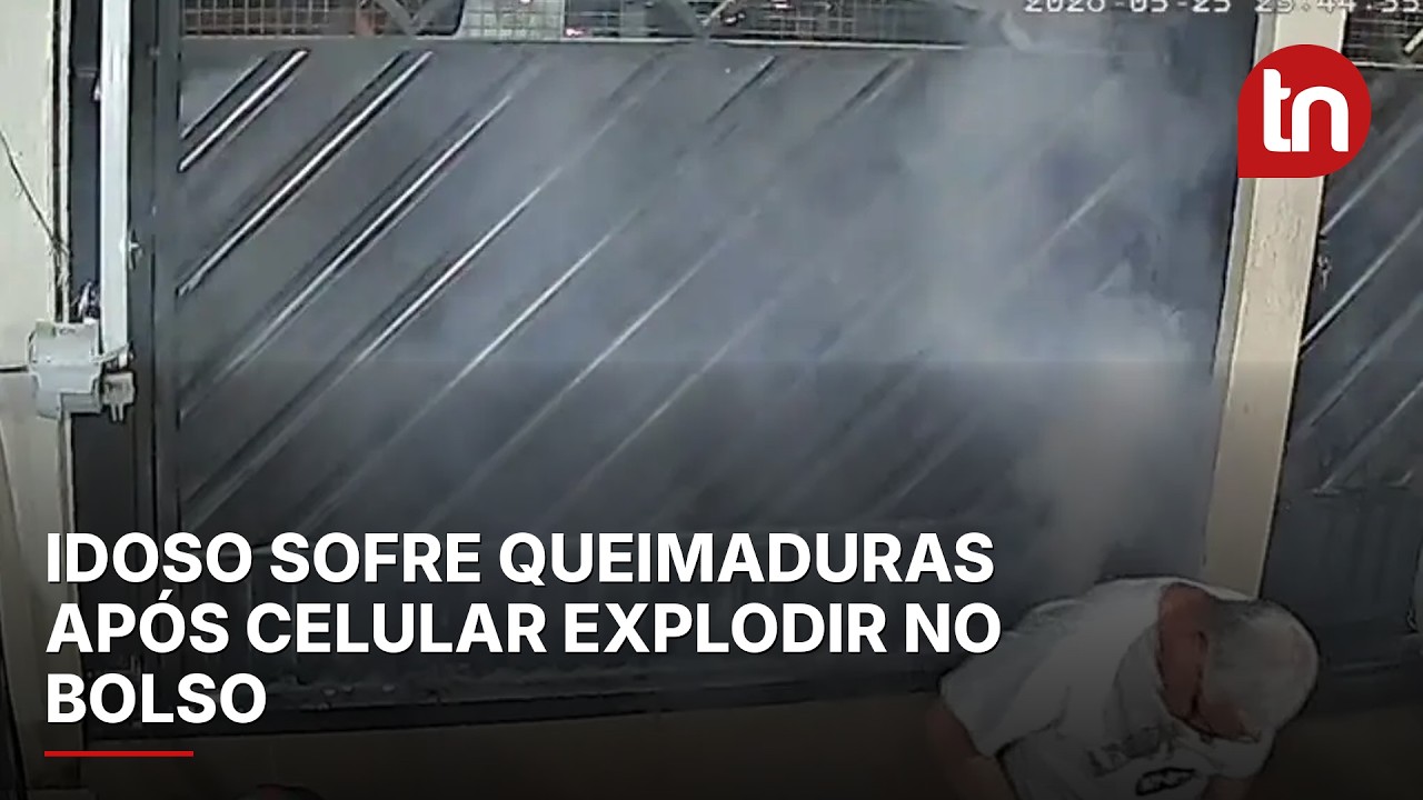 Idoso sofre queimaduras após celular explodir no bolso