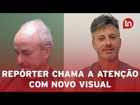Prótese capilar de repórter chama atenção em Apucarana: 'Muito feliz'