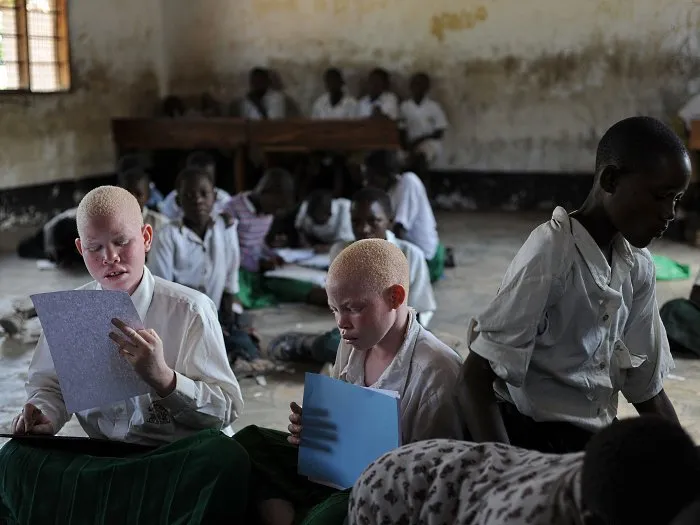  Imagem de arquivo mostra crianças albinas refugiadas em escola para cegos na Tanzânia