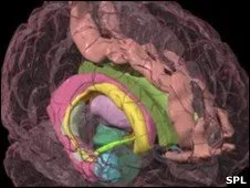  Imagem computadorizada de um cérebro mostra amígdalas em cor azul