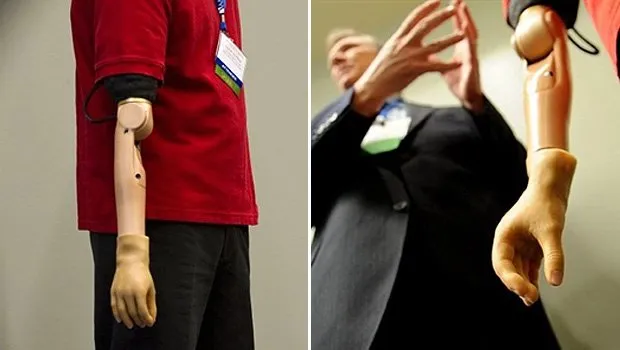  Todd Kuiken apresenta braço que pode ser controlado por impulsos do cérebro