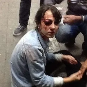 Repórter da Folha recebe alta após ser ferida em manifestação