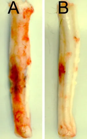  Medula espinhal de ratos 24 horas após ferimento cervical: a cobaia B recebeu tratamento para silenciar o gene Abcc8, com uma notável redução de hemorragia