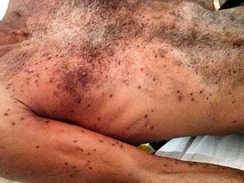  Homem morre após ser picado por abelhas em praça (Foto: Marcelo Moraes/Força Tática PM - Pontes e Lacerda)