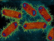  Bactéria como a E.Coli podem ter o gene NDM-1