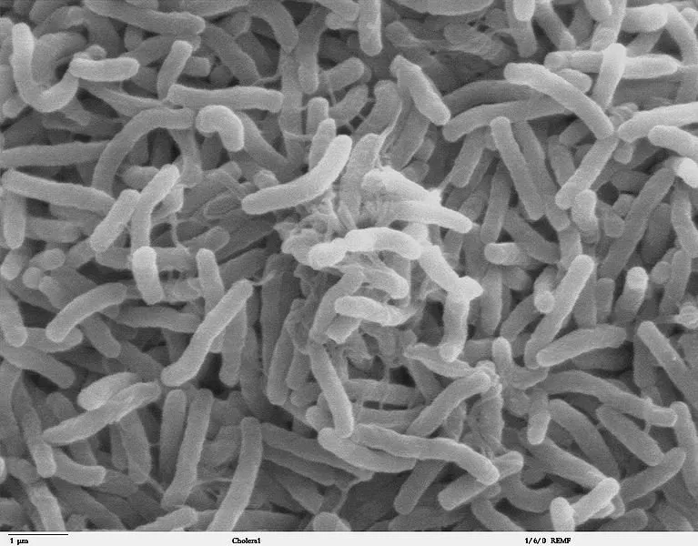  Vibrio cholerae: A bactéria que causa cólera (ao microscópio eletrônico).