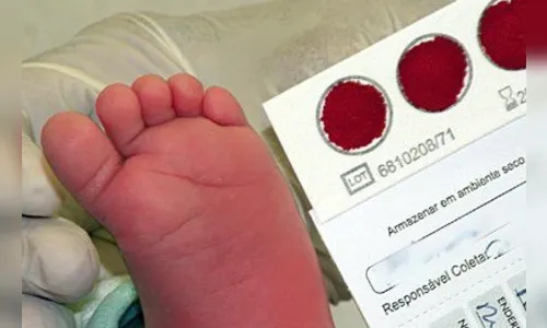 No Paraná, teste do pezinho passa a identificar 11 doenças 
