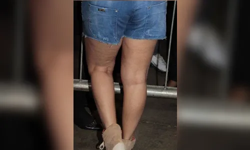 Figurino de Carla Perez revela ação do tempo nas pernas