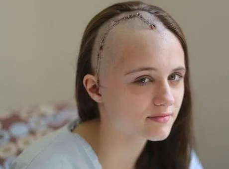 Sophia Putney-Wilcox, 17 anos, foi ferida pelo ex-namorado
