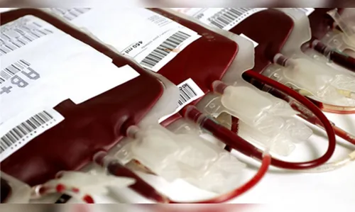 Proibir homens que fazem sexo com homens de doarem sangue é inconstitucional?