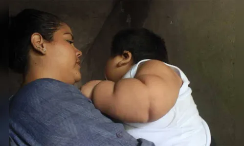 Família pede auxílio para tratar criança de 10 meses que pesa 30 kg; veja vídeo