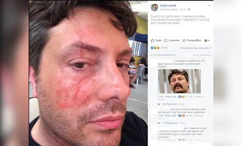 Internautas desconfiam que acidente de Danilo Gentili é pegadinha