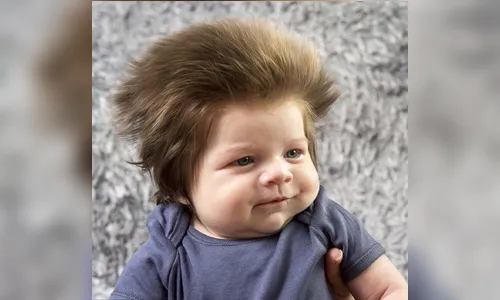 Veja como está o bebê cabeludo