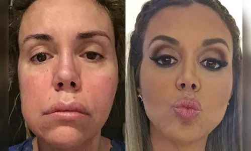 Renata Banhara volta ao trabalho após cirurgias no cérebro: 