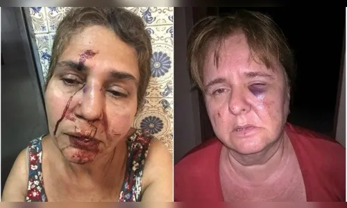 Mulheres são espancadas por dois vizinhos após desentendimento em edifício (vídeo)