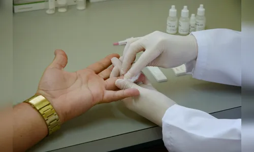 Casos de Aids preocupam entre homens com menos de 34 anos