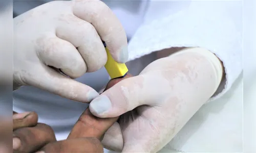 Secretaria de Saúde desenvolve ações no Dia Mundial de Combate a AIDS