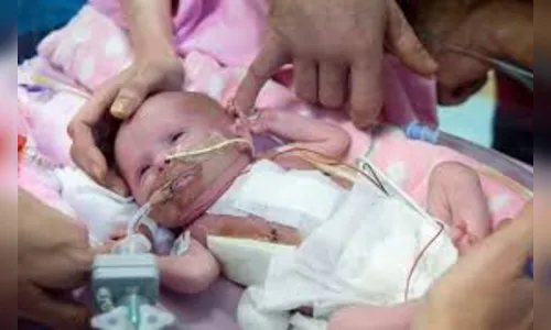 Menina com coração fora do corpo nasce no Reino Unido; veja vídeo