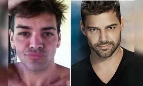Argentino passa por 17 cirurgias plásticas para se tornar Ricky Martin