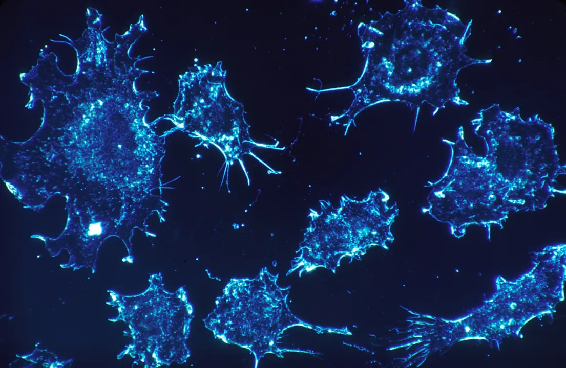 Células cancerosas - Foto - Pixabay - Imagem ilustrativa