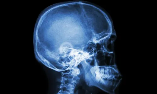Médicos não acham coágulo e descobrem que abriram a cabeça errada
