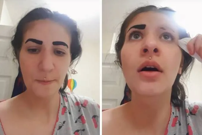 Moça perdeu as sobrancelhas ao usar produto para tingimento - FOTO DAILY MAIL/REPRODUÇÃO