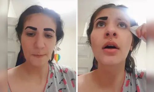 Moça perde sobrancelhas ao usar produto para tingimento; veja vídeo