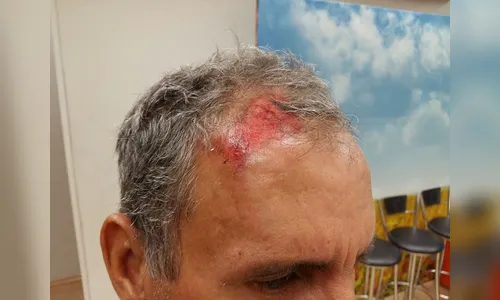 Casal agride sorveteiro com pancada na cabeça durante assalto 