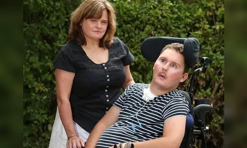 Australiano é desafiado a comer lesma viva e fica tetraplégico 