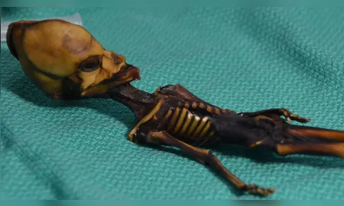 Suposto esqueleto de alien pertencia a humano que sofreu mutações