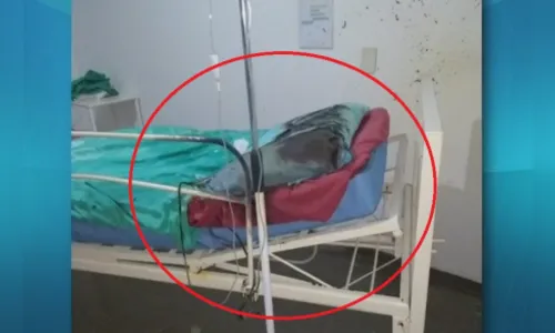 Paciente sofre queimaduras graves após explosão de cilindro de oxigênio em hospital
