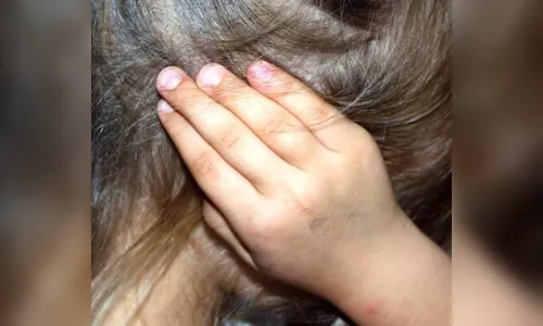 Apucarana abre campanha de Combate ao Abuso e Exploração Sexual de Crianças e Adolescentes