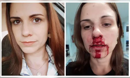 Mulher publica foto com rosto ensanguentado para denunciar agressão do ex: 'Cansei de me calar'