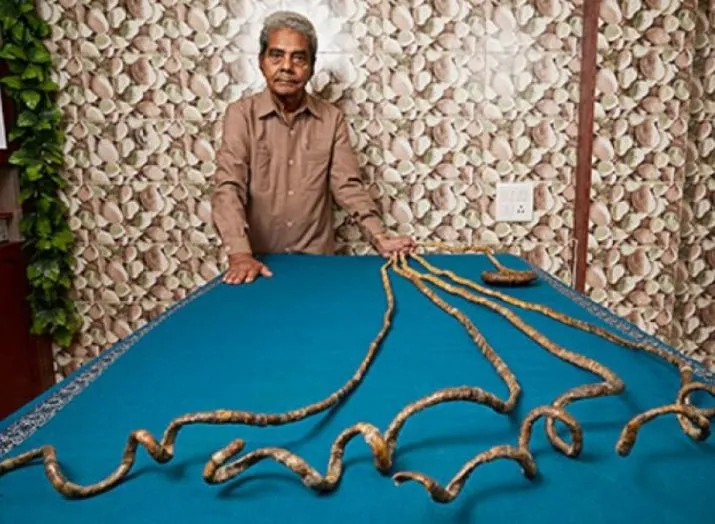 Indiano decidiu cortar unhas mais compridas do mundo depois de 66 anos - Foto: Reprodução/Twitter