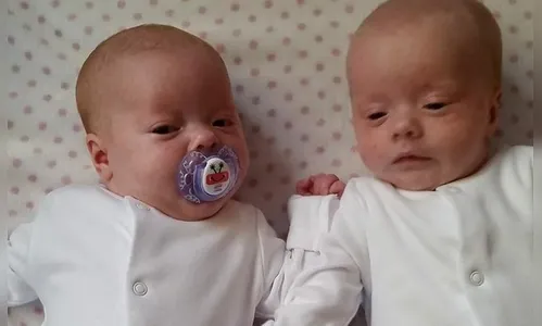 Sem saber de gestação, mulher dá à luz a gêmeas ao fazer xixi