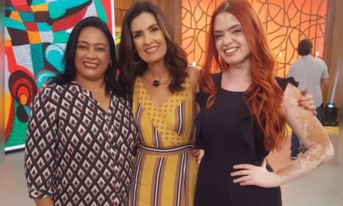 Apucaranense com vitiligo é convidada de hoje no programa da Fátima Bernardes